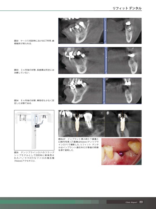 最新 骨補填材料＆メンブレンYEARBOOK 2021/2022