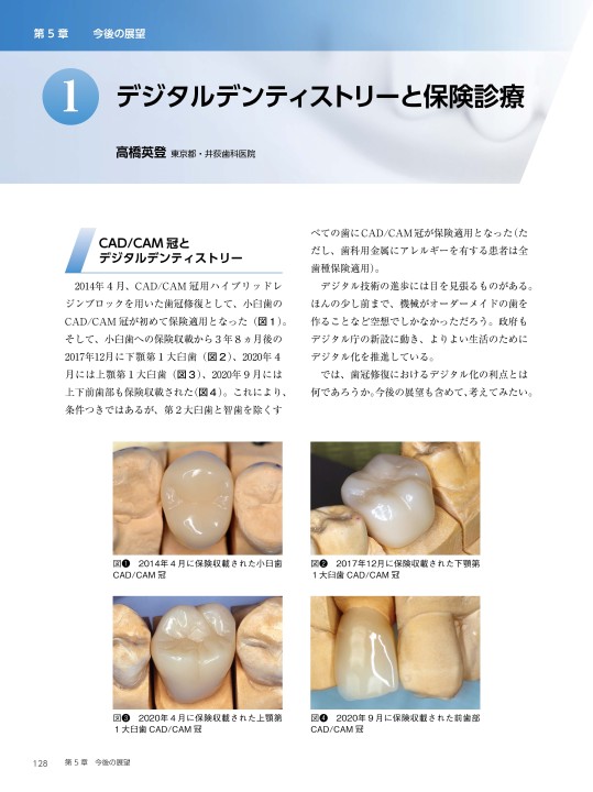CAD／CAM冠の適応範囲拡大 大臼歯から前歯まで CAD⁄CAM冠の適応範囲拡大 大臼歯から前歯まで⁄坪田有史 .