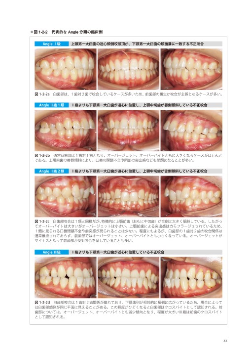 Limited Orthodontic Treatment(LOT) (藤本研修会Standard Textbook 3) Amazon.co.jp: Limited Orthodontic Treatment(LOT) (藤本研修会