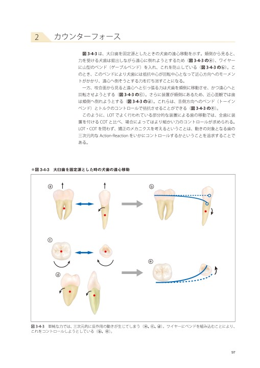藤本研修会 Standard Textbook 3 Limited Orthodontic Treatment