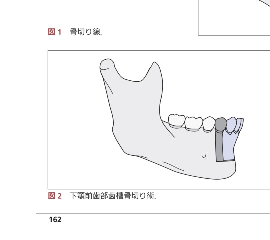 顎矯正手術エッセンシャル 51f9EcYnzmL._AC_SY200_QL15_.jpg