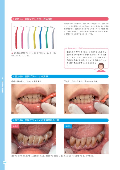 今からはじめる歯科衛生士のための訪問歯科マニュアル