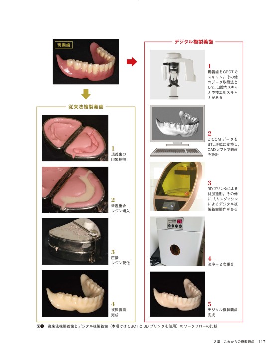 コピーデンチャーズ 複製義歯の製作とその活用法