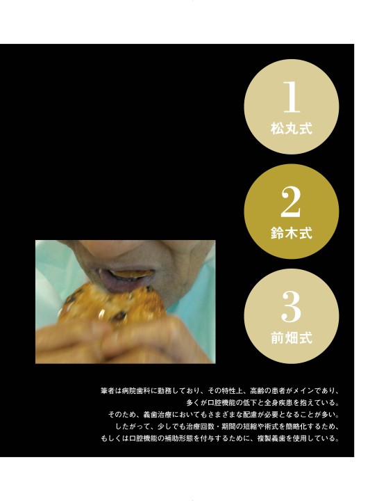COPY DENTURES コピーデンチャーズ　複製義歯の製作とその活用法 imgg.php?id=1008&img=images/