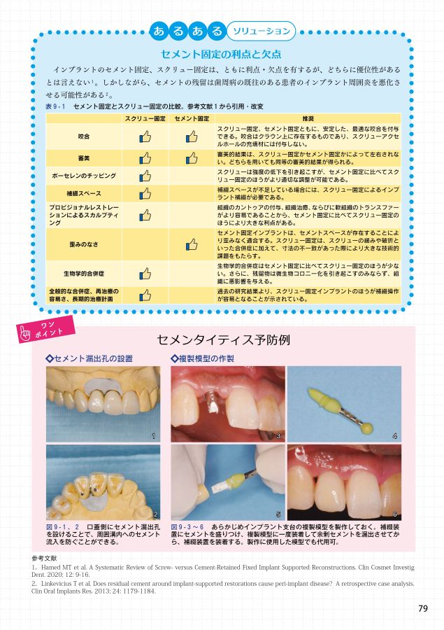 筒井昌秀臨床DVD3 インプラント周囲軟組織のマネジメント