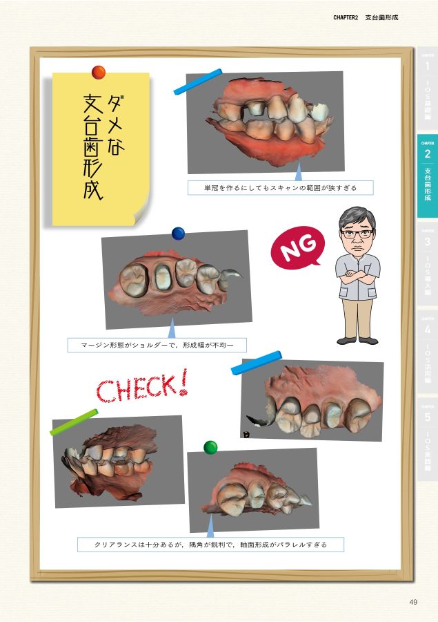 The Basic Planes for Tooth Preparation 支台歯形成の面基準