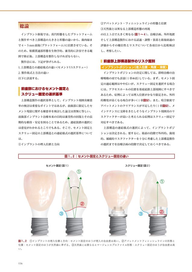 即時治療の真髄 : 補綴的要件を達成するための即時埋入と即時負荷 即時治療の真髄: 補綴的要件を達成するための即時埋入と即時負荷