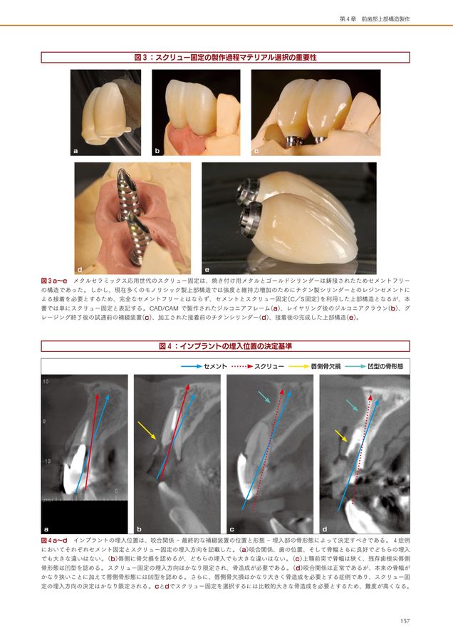 即時治療の真髄