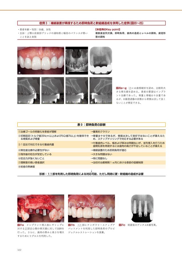 即時治療の真髄: 補綴的要件を達成するための即時埋入と即時負荷