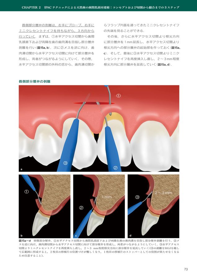 乳頭乳輪の再建方法について | いしblog☆ 40歳独身、内定後
