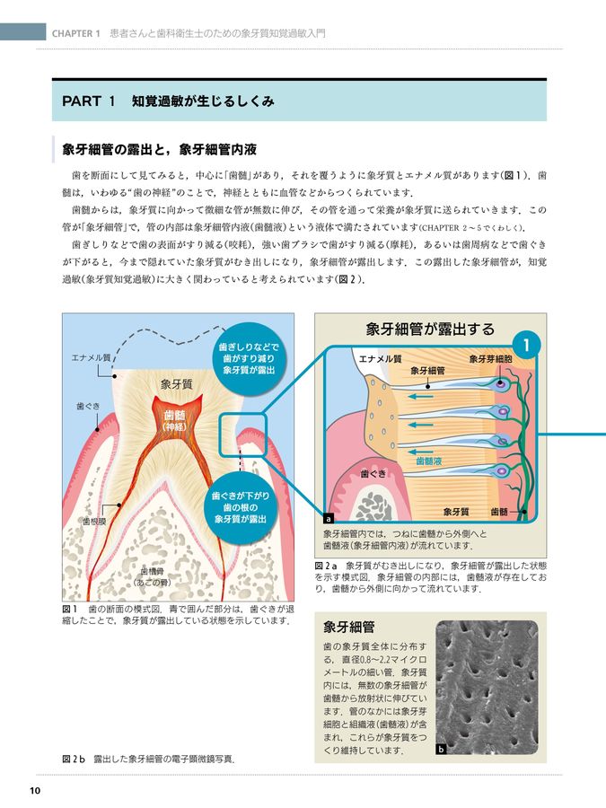 超速でわかる象牙質知覚過敏: Dr.とDHのための最新知識と製品情報 Amazon.co.jp: 超速でわかる象牙質知覚過敏: Dr.とDHのための