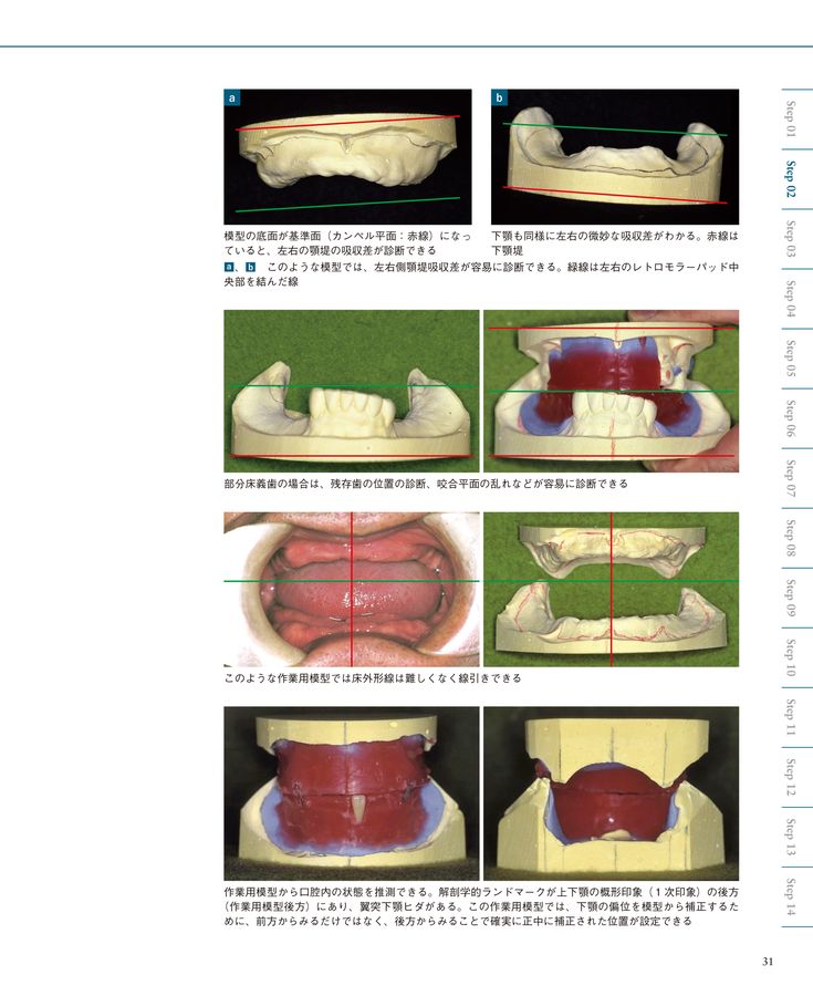 総義歯臨床の押さえどころ 総義歯臨床の押さえどころ/医歯薬出版株式会社
