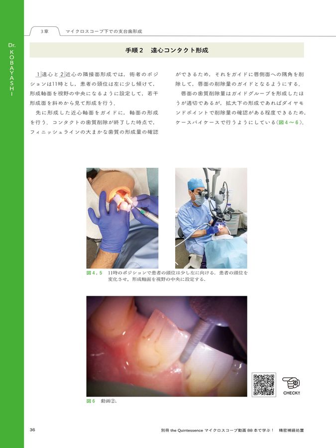 マイクロスコープ動画88本で学ぶ! 精密補綴処置: 支台歯形成