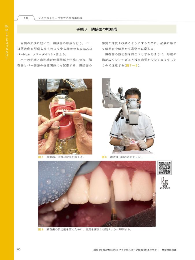 マイクロスコープ動画88本で学ぶ！ 精密補綴処置