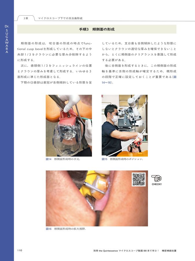 マイクロスコープ動画88本で学ぶ！ 精密補綴処置_no_link