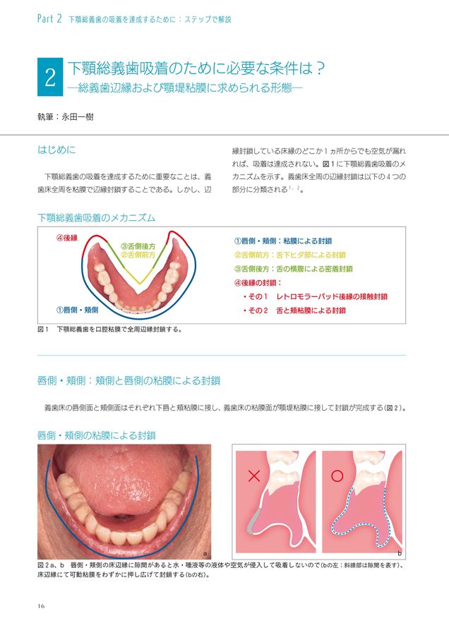 Amazon.co.jp: 誰にでもできる下顎総義歯の吸着 : 阿部二郎: 本