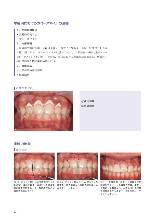 ガミーページ ガミースマイル