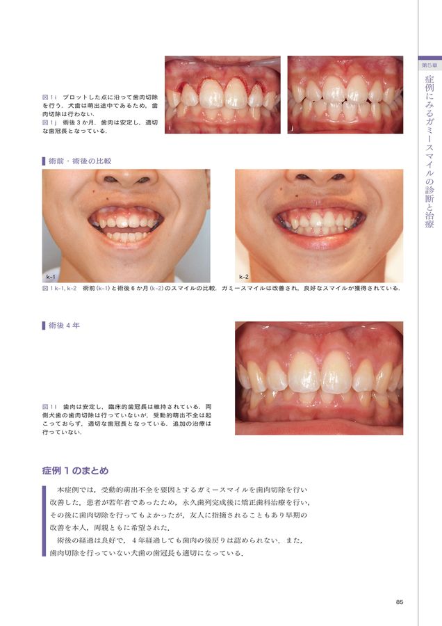ガミーページ ガミースマイル