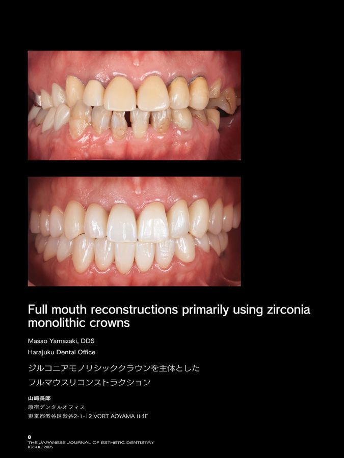 裁断済み藤本研修会　Occlusion & Prosthodontics 2 藤本研修会 Standard Textbook 2 Occlusion & Prosthodontics