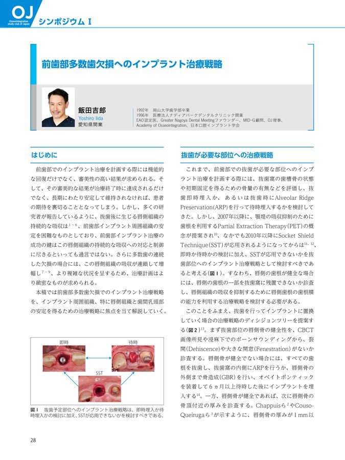 インプラント周囲軟組織のマネジメント 4 インプラント周囲炎の軟組織管理 | Doctorbook academy