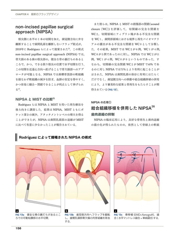 フラップデザイン アドバンス編