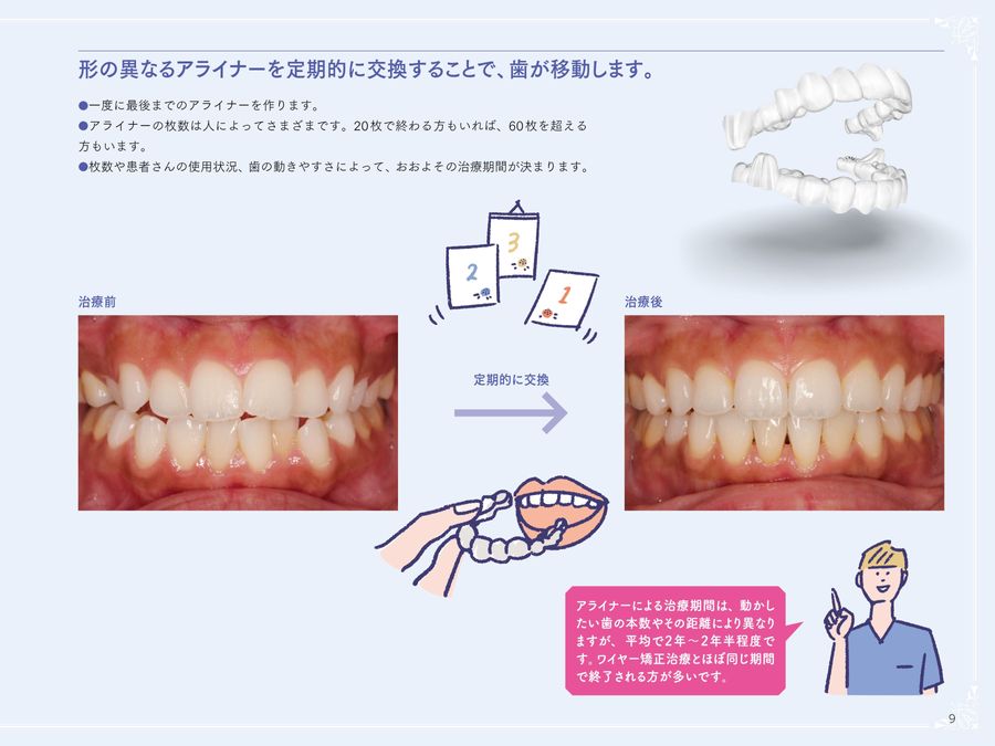 【裁断済み】アライナー矯正治療受診ナビ　矯正治療をご希望の方へ アライナー矯正治療受診ナビ: 矯正治療をご希望の方へ | 西井 康