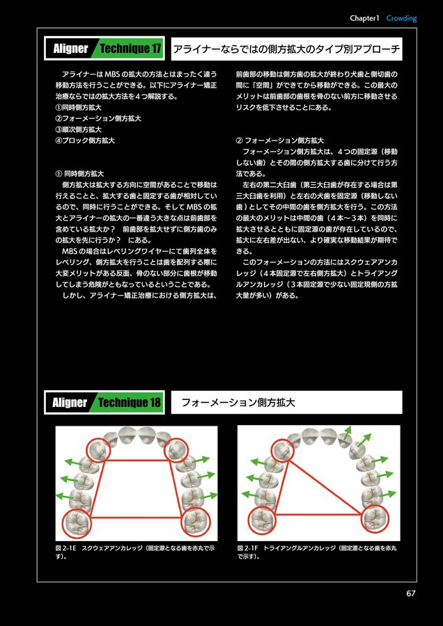 アライナージェネレーション アライナージェネレーション