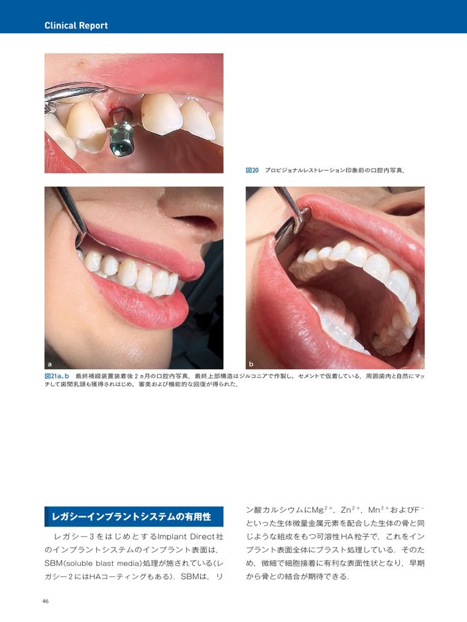 インプラントYEARBOOK 2025