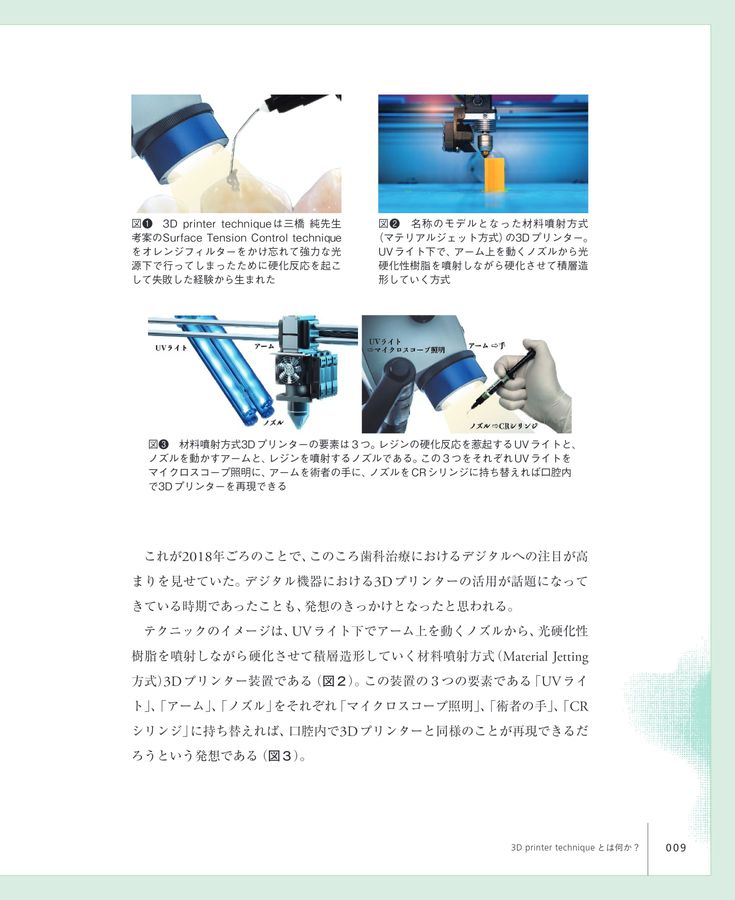 脱マトリックス！フリーハンドのII級窩洞CR充填 3D printer