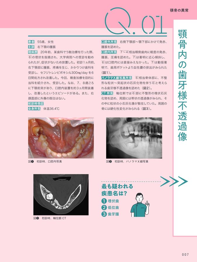 診断力アップのための口腔疾患Q&A 83