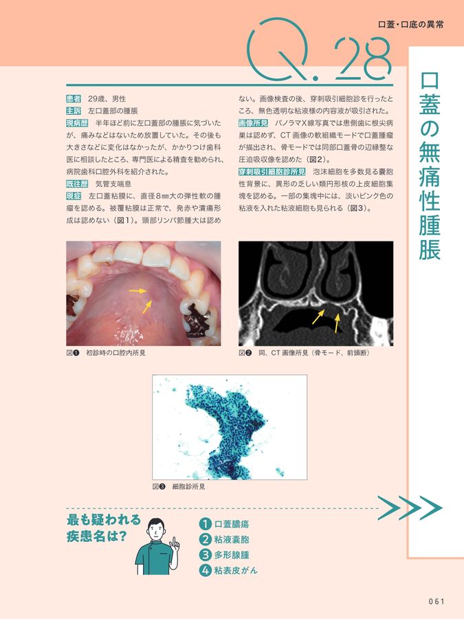 口腔・咽頭疾患,歯牙関連疾患を診る 口腔・咽頭疾患,歯牙関連疾患を診る (ENT臨床フロンティア