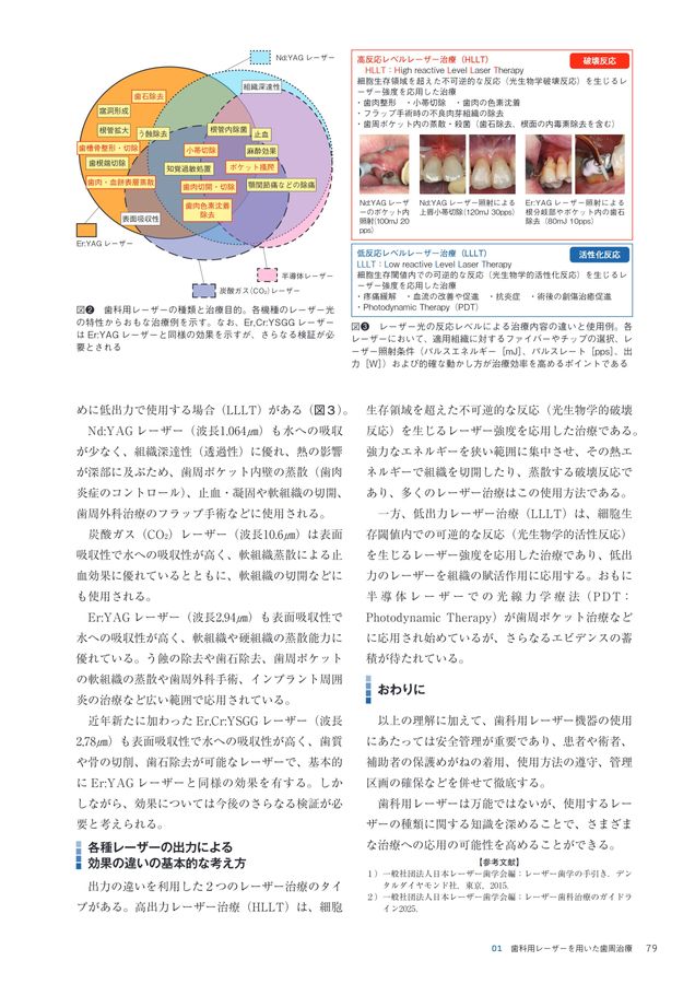 歯科用レーザーの臨床症例集 シエン社 | レーザー歯科治療
