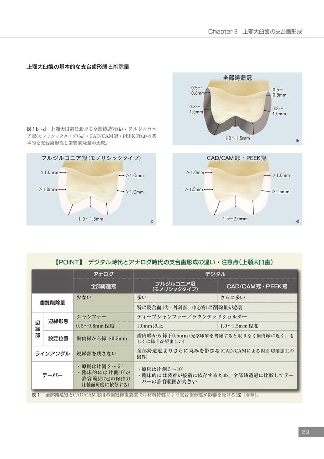 歯冠修復　下 歯冠修復説明用 – 【公式】広島市の歯科技工所「株式会社アート