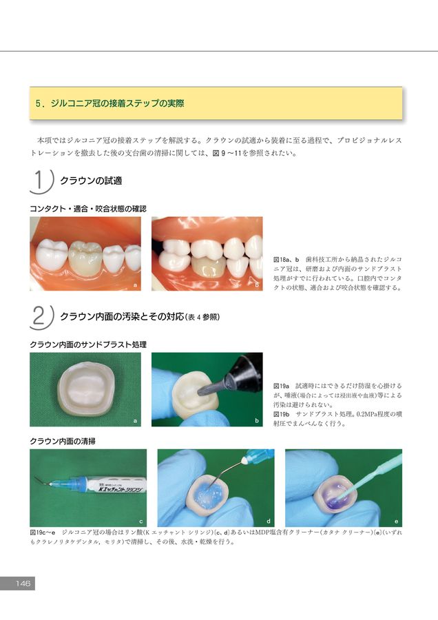 デジタル時代の歯冠修復 必ず上達 デジタル時代の歯冠修復 - クインテッセンス出版