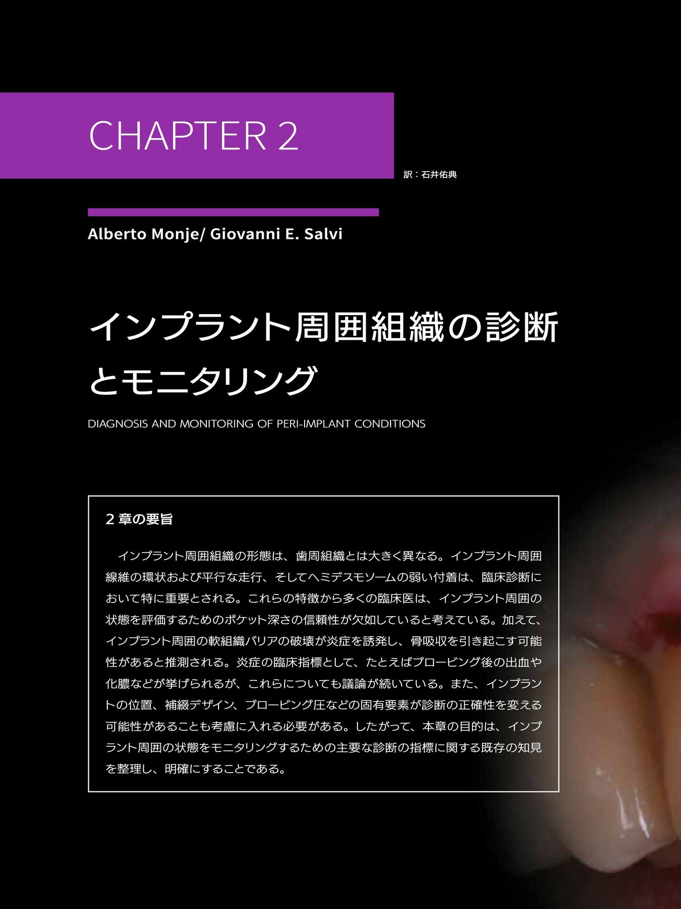 書籍 やさしい・失敗しない 低侵襲ソフトティッシュマネジメント