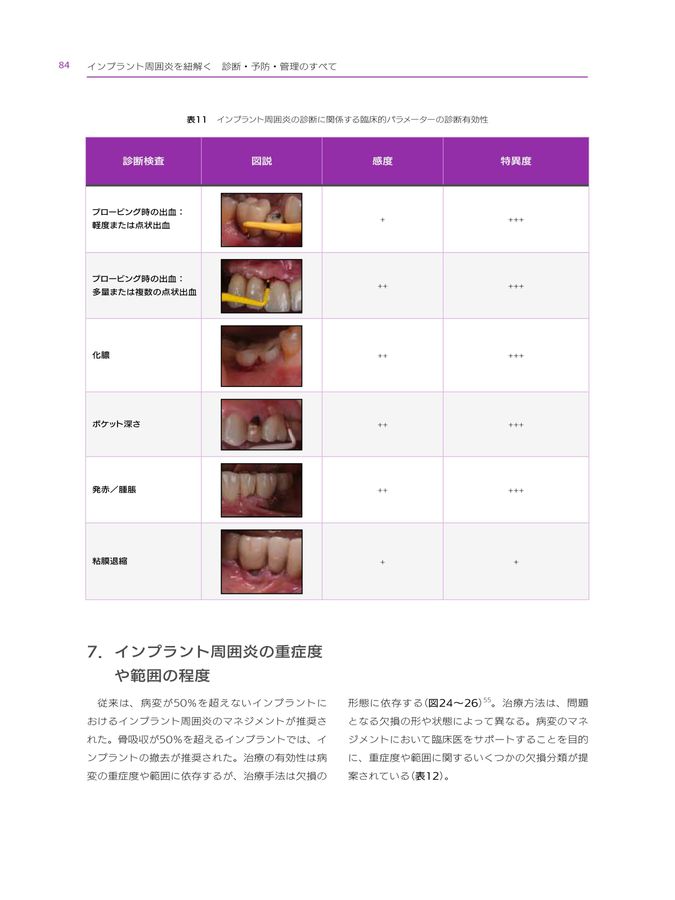 インプラント周囲炎を紐解く