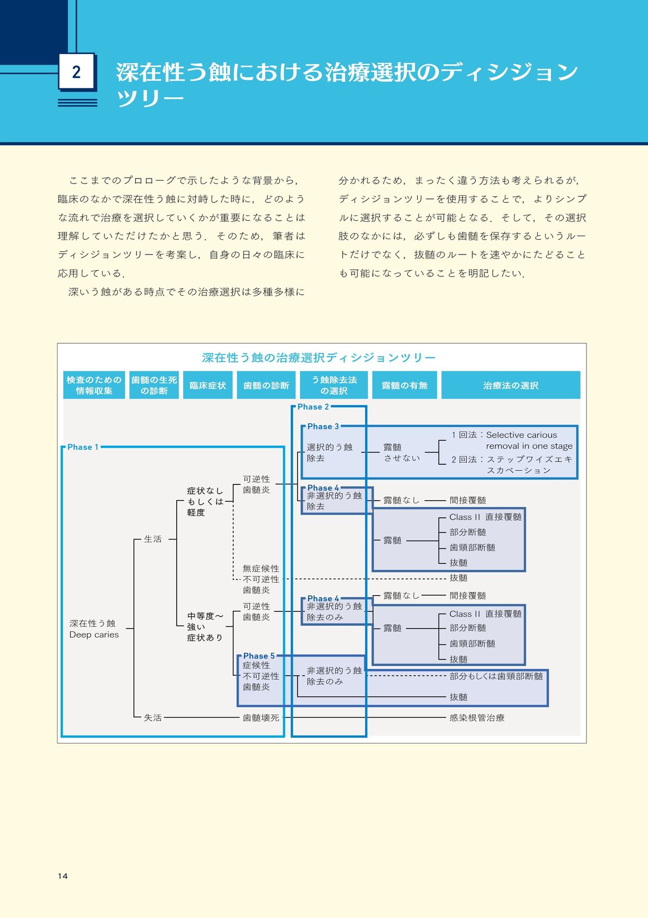 深在性う蝕に対するVital Pulp Therapy