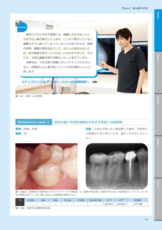 Vital Pulp Therapy 深在性う蝕に対する治療法 深在性う蝕に対するVital Pulp Therapy