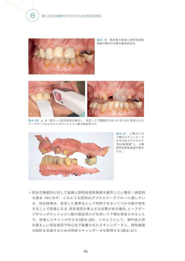 咬合の臨床応用