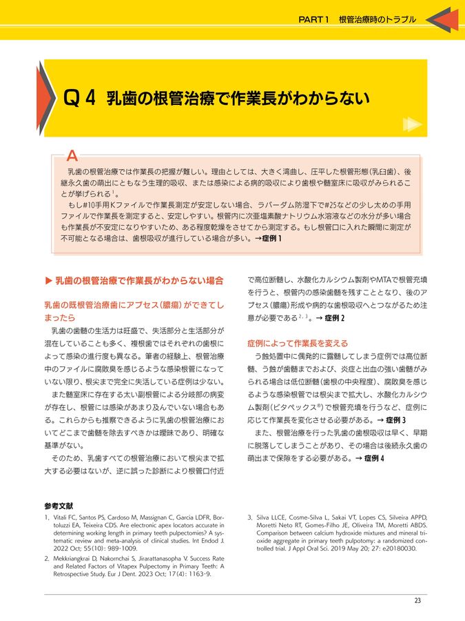 完全解説 根管治療トラブル攻略本 : エンドのよくある24の難局面大攻略 シエン社 | 完全解説 根管治療トラブル攻略本