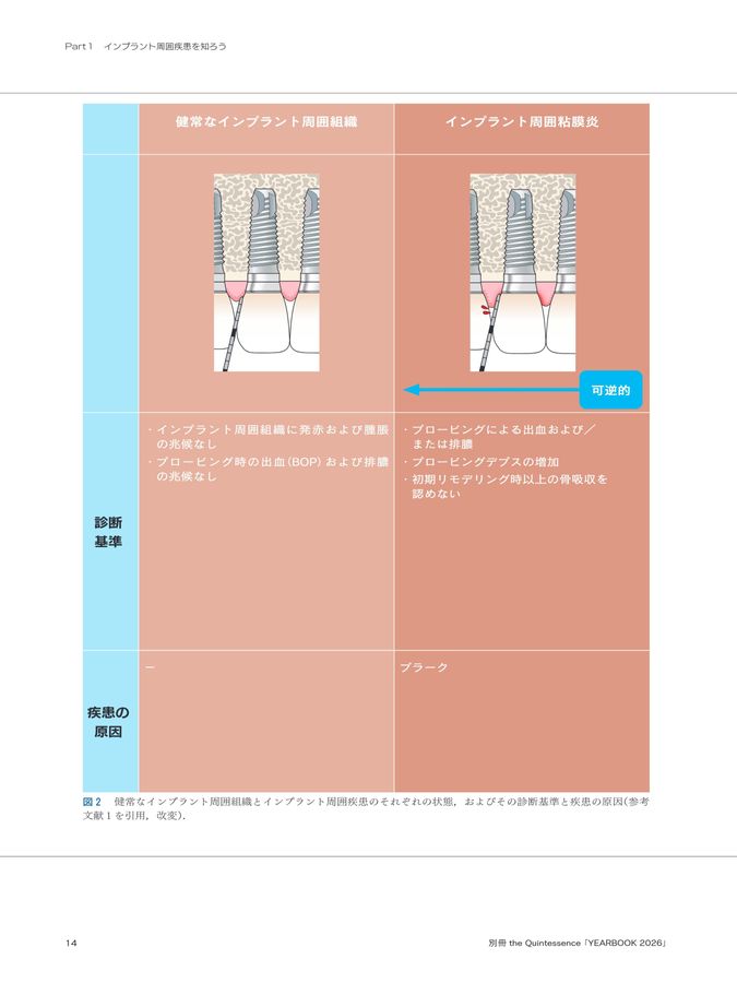 YEARBOOK2026_これ1冊ですべて学べる！_インプラント周囲疾患対応