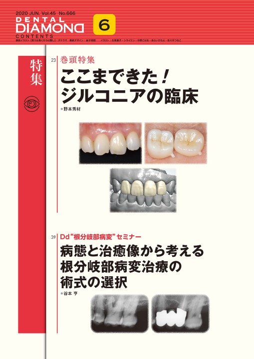 デンタルダイヤモンド 2020年6月号