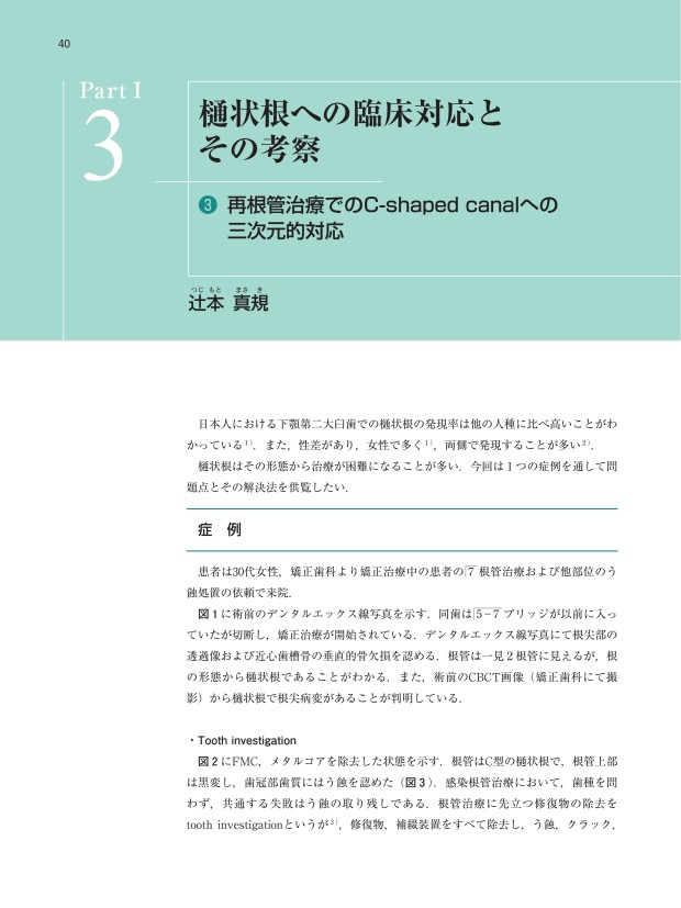 樋状根とRadix Entomolarisへの対応