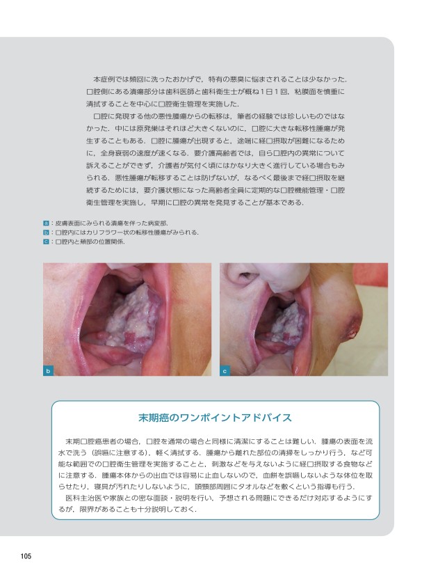 口腔病変クローズアップ 要介護高齢者の口腔病変アトラス