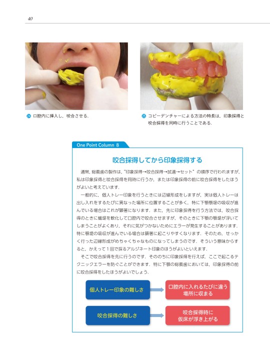 総義歯の痛い外れるにどう対処するか